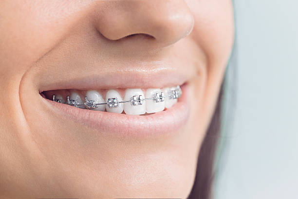 Best Dental Inlays and Onlays  in Weston Mills, NY